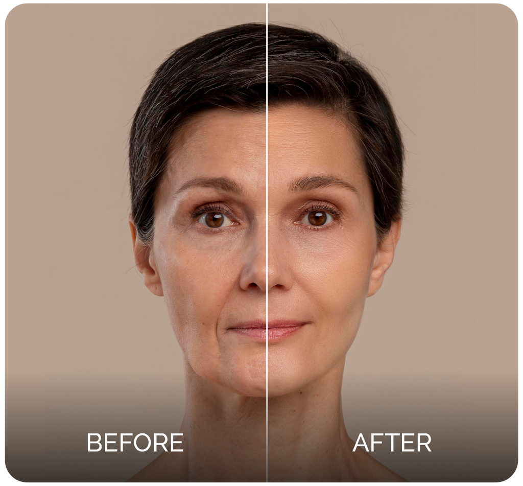 QYRA® - The Gold Standard For Collagen
